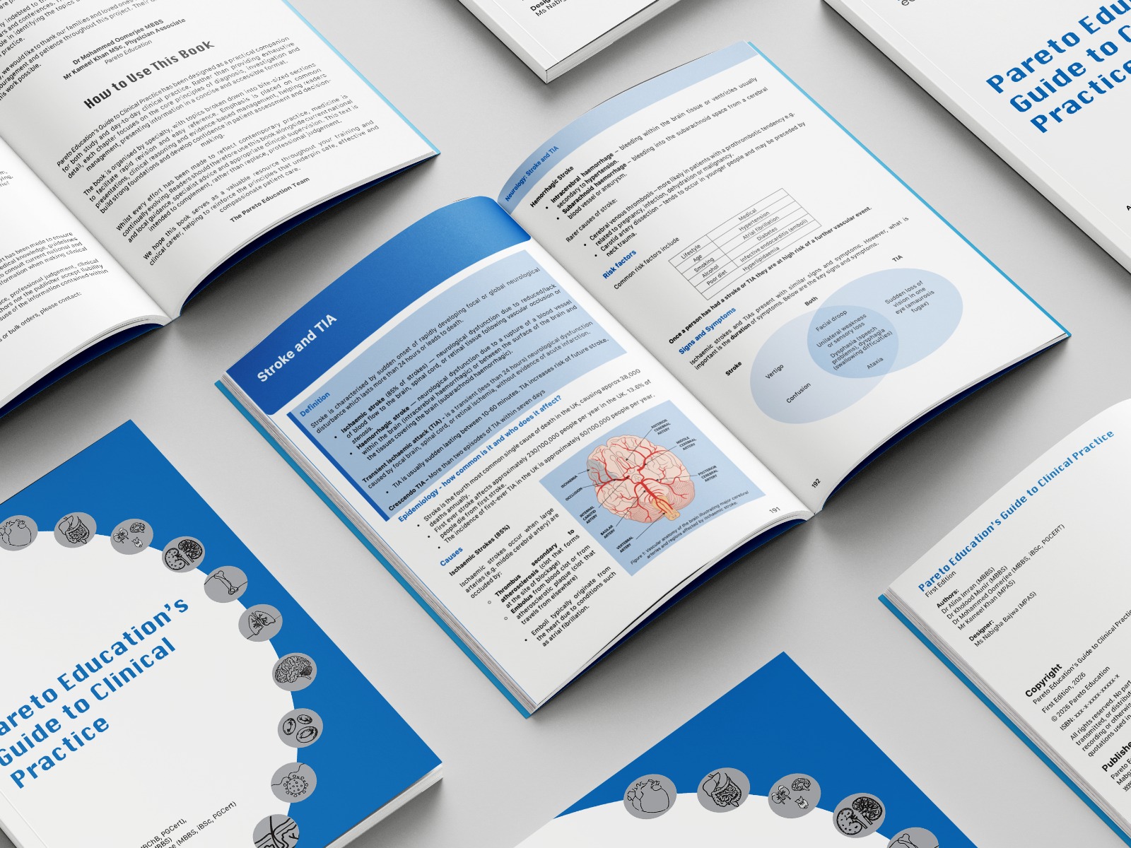 Several open copies showing the Stroke and TIA spread with its definition, epidemiology and a labelled brain figure